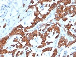 EpCAM/TROP1 Antibody (EGP40/1555R) - (ECD), Novus Biologicals 100&mu;g;