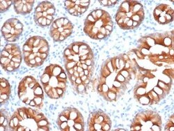 EpCAM/TROP1 Antibody (EGP40/1555R) - (ECD), Novus Biologicals 100&mu;g;