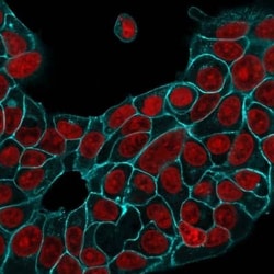 EpCAM/TROP1 Antibody (EGP40/1556R) - (ECD), Novus Biologicals 100&mu;g;