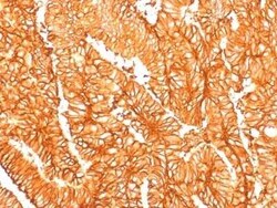 EpCAM/TROP1 Antibody (EGP40/1556R) - (ECD), Novus Biologicals 100&mu;g;