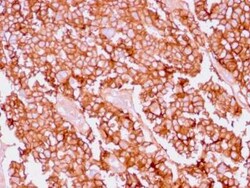 EpCAM/TROP1 Antibody (EGP40/1556R) - (ECD), Novus Biologicals 100&mu;g;