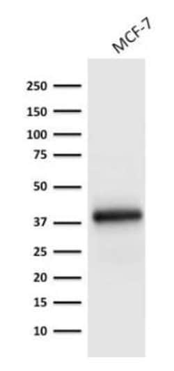 EpCAM/TROP1 Antibody (EGP40/1798) - (ECD), Novus Biologicals:Antibodies:Primary