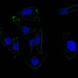 EpCAM/TROP1 Antibody (EGP40/837) - (ECD), Novus Biologicals 0.02mg; Unlabeled:Antibodies,