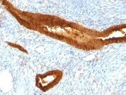 EpCAM/TROP1 Antibody (EGP40/837) - (ECD), Novus Biologicals 0.02mg; Unlabeled:Antibodies,