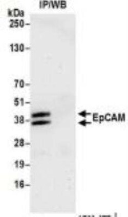 EpCAM/TROP1 Antibody (BLR077G), Novus Biologicals 100 &mu;g; Unconjugated:Antibodies,