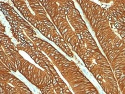 EpCAM/TROP1 Antibody (MOC-31), Novus Biologicals:Antibodies:Primary Antibodies