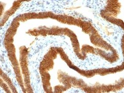 EpCAM/TROP1 Antibody (MOC-31), Novus Biologicals:Antibodies:Primary Antibodies