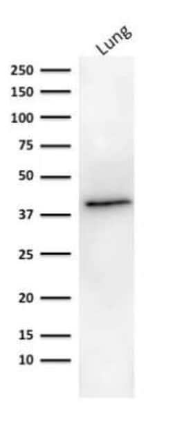 EpCAM/TROP1 Antibody (MOC-31), Novus Biologicals:Antibodies:Primary Antibodies