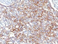 EpCAM/TROP1 Antibody (PAN-EpCAM (Cocktail)), Novus Biologicals 0.02mg;