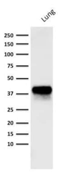 EpCAM/TROP1 Antibody (PAN-EpCAM (Cocktail)), Novus Biologicals 0.02mg;
