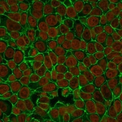 EpCAM/TROP1 Antibody (VU-1D9), Novus Biologicals:Antibodies:Primary Antibodies