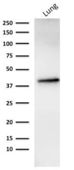 EpCAM/TROP1 Antibody (rMOC-31), Novus Biologicals 100&mu;g; Unlabeled:Antibodies,