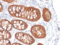 EpCAM/TROP1 Antibody (rVU-1D9) - (ECD), Novus Biologicals:Antibodies:Primary