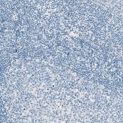 EpCAM/TROP1 Antibody (CL6313), Novus Biologicals:Antibodies:Primary Antibodies
