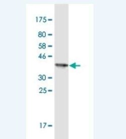EphA1 Antibody (8D4), Novus Biologicals 100 &mu;g | Buy Online | Novus Biologicals | Fisher Scientific