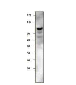 EphA3 Antibody, Novus Biologicals 100 &mu;g | Buy Online | Bio-Techne | Fisher Scientific