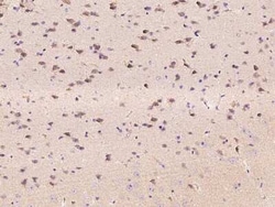EphA6 Antibody, Novus Biologicals:Antibodies:Primary Antibodies