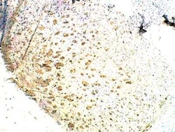 EphB1 Antibody, Novus Biologicals 100 &mu;g | Buy Online | Novus Biologicals | Fisher Scientific