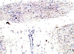 EphB1 Antibody, Novus Biologicals 100 &mu;g | Buy Online | Novus Biologicals | Fisher Scientific