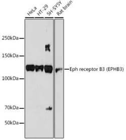 EphB3 Rabbit anti-Human, Mouse, Rat, Clone: 8H9P4, Novus Biologicals 20