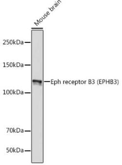 EphB3 Rabbit anti-Human, Mouse, Rat, Clone: 8H9P4, Novus Biologicals 20