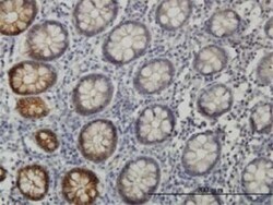 EphB3 Antibody (1B3), Novus Biologicals 0.1 mg | Buy Online | Novus Biologicals | Fisher Scientific