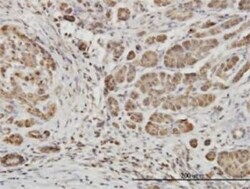 EphB6 Antibody (5D8), Novus Biologicals 0.1 mg | Buy Online | Novus Biologicals | Fisher Scientific