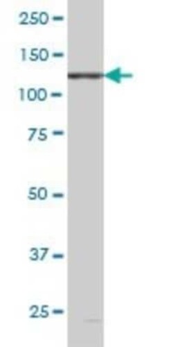 EphB6 Antibody (5D8), Novus Biologicals 0.1 mg | Buy Online | Novus Biologicals | Fisher Scientific
