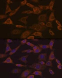 Ephrin-A1 Rabbit anti-Human, Mouse, Clone: 5D4Q5, Novus Biologicals 20