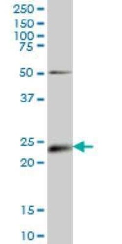 Ephrin-A5 Antibody (1F12), Novus Biologicals 0.1 mg, Unconjugated:Antibodies,