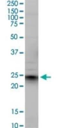 Ephrin-A5 Antibody (1F12), Novus Biologicals 0.1 mg, Unconjugated:Antibodies,