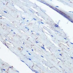 Ephrin-B2 Rabbit anti-Human, Mouse, Rat, Clone: 1G9E7, Novus Biologicals:Antibodies:Primary