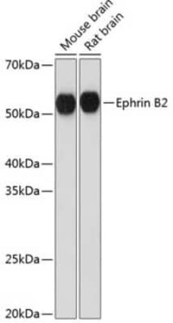 Ephrin-B2 Rabbit anti-Human, Mouse, Rat, Clone: 1G9E7, Novus Biologicals:Antibodies:Primary