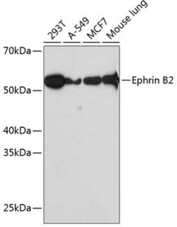 Ephrin-B2 Rabbit anti-Human, Mouse, Rat, Clone: 1G9E7, Novus Biologicals:Antibodies:Primary