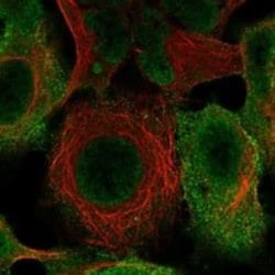 Epsin 1 Rabbit anti-Human, Polyclonal, Novus Biologicals 100 &mu;g; Unconjugated:Antibodies,