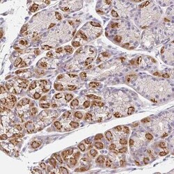 Epsin 3 Antibody, Novus Biologicals 25 &mu;L, Unconjugated:Antibodies,