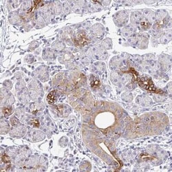 Epsin 3 Antibody, Novus Biologicals 25 &mu;L, Unconjugated:Antibodies,