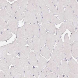 Epsin 3 Antibody, Novus Biologicals 25 &mu;L, Unconjugated:Antibodies,