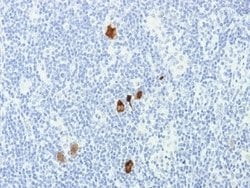 Epstein Barr Virus Mouse anti-Virus, Clone: CS1-4, Novus Biologicals 20