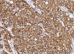 ErbB2/Her2 Rabbit anti-Human, Clone: 2, Novus Biologicals:Antibodies:Primary