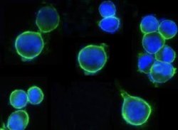 ErbB2/Her2 Rabbit anti-Human, Clone: 511, Novus Biologicals 50 &mu;g; Unconjugated:Antibodies,
