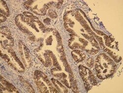 ErbB2/Her2 Antibody (A24-V), Novus Biologicals 100 &mu;L | Buy Online | Novus Biologicals | Fisher Scientific