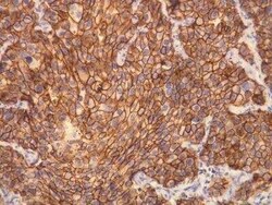 ErbB2/Her2 Antibody (A24-V), Novus Biologicals 100 &mu;L | Buy Online | Novus Biologicals | Fisher Scientific