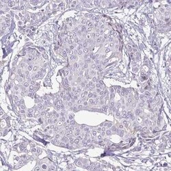 ErbB2/Her2 Antibody (CL0268), Novus Biologicals 25 &mu;L, Unconjugated:Antibodies,