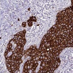 ErbB2/Her2 Antibody (CL0268), Novus Biologicals 25 &mu;L, Unconjugated:Antibodies,