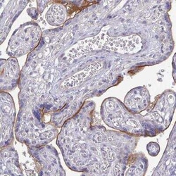 ErbB2/Her2 Antibody (CL0268), Novus Biologicals:Antibodies:Primary Antibodies