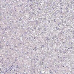 ErbB2/Her2 Antibody (CL0268), Novus Biologicals 25 &mu;L, Unconjugated:Antibodies,