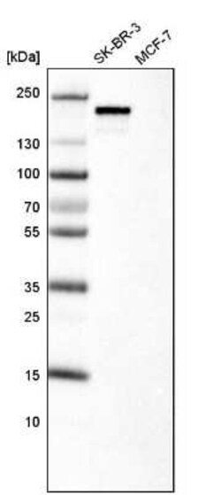 ErbB2/Her2 Antibody (CL0268), Novus Biologicals 25 &mu;L, Unconjugated:Antibodies,