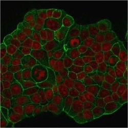 ErbB2/Her2 Antibody (ERB2/776), Novus Biologicals:Antibodies:Primary Antibodies