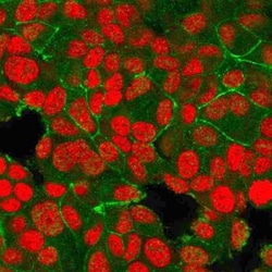 ErbB2/Her2 Antibody (HRB2/718), Novus Biologicals:Antibodies:Primary Antibodies